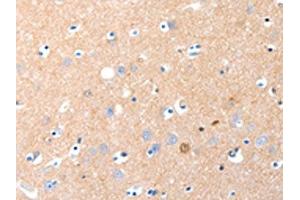 The image on the left is immunohistochemistry of paraffin-embedded Human brain tissue using ABIN7190883(GRM1 Antibody) at dilution 1/15, on the right is treated with synthetic peptide. (Metabotropic Glutamate Receptor 1 抗体)