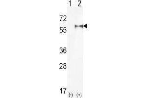 Western Blotting (WB) image for anti-Phosphatidylinositol-4-Phosphate 5-Kinase, Type I, alpha (PIP5K1A) antibody (ABIN3003646) (PIP5K1A 抗体)