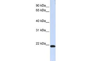 WB Suggested Anti-TJAP1 Antibody Titration:  0. (TJAP1 抗体  (N-Term))