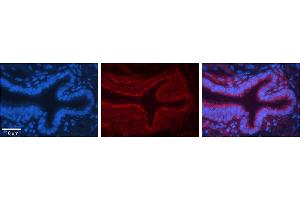 Rabbit Anti-ME1 Antibody     Formalin Fixed Paraffin Embedded Tissue: Human Bronchial Epithelial Tissue  Observed Staining: Cytoplasmic  Primary Antibody Concentration: 1:100  Secondary Antibody: Donkey anti-Rabbit-Cy3  Secondary Antibody Concentration: 1:200  Magnification: 20X  Exposure Time: 0. (ME1 抗体  (N-Term))