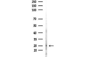 anti-Coenzyme Q10 Homolog B (COQ10B) antibody