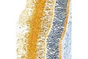 Immunohistochemistry (Paraffin-embedded Sections) (IHC (p)) image for anti-Fibroblast Growth Factor 11 (FGF11) antibody (ABIN7073941)