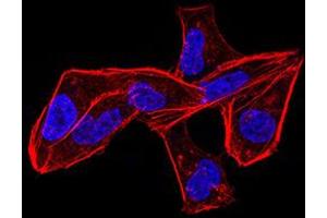 Immunocytochemistry (ICC) image for anti-Aldehyde Dehydrogenase 6 Family, Member A1 (ALDH6A1) (AA 1-195) antibody (ABIN5856297) (ALDH6A1 抗体  (AA 1-195))