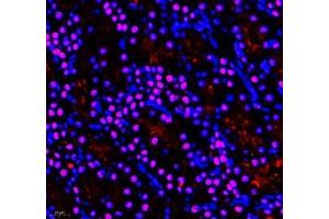 Immunofluorescence (Paraffin-embedded Sections) (IF (p)) image for anti-General Transcription Factor IIIC, Polypeptide 3, 102kDa (GTF3C3) antibody (ABIN7074039)