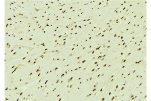 ABIN6276442 at 1/100 staining Mouse brain tissue by IHC-P. (RPA1 抗体  (Internal Region))