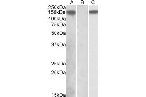 HEK293 lysate (10ug protein in RIPA buffer) overexpressing Human NLRP2 with DYKDDDDK tag probed with ABIN768539 (1ug/ml) in Lane A and probed with anti- DYKDDDDK Tag (1/1000) in lane C. (NLRP2 抗体  (C-Term))