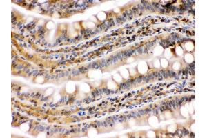 Immunohistochemistry (IHC) image for anti-Heat Shock Protein 90kDa alpha (Cytosolic), Class B Member 1 (HSP90AB1) (AA 449-481), (C-Term) antibody (ABIN3042462)