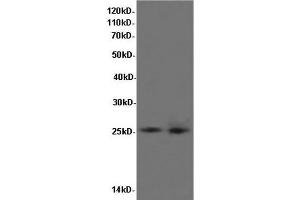 Western Blot analysis of K562 cells and Rat liver tissue using BCL-x Polyclonal Antibody at dilution of 1:600 (BCL2L1 抗体)