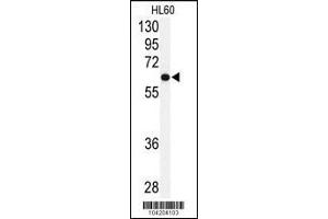 Western blot analysis of anti-USP2 Antibody in HL60 cell line lysates (35ug/lane) (USP2 抗体  (C-Term))