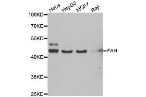 Western blot analysis of extracts of various cell lines, using FAH antibody. (FAH 抗体  (AA 1-419))
