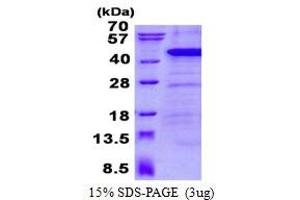 Image no. 1 for Ankyrin Repeat Domain 1 (Cardiac Muscle) (ANKRD1) (AA 1-319) protein (His tag) (ABIN6387032)
