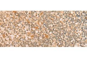Immunohistochemistry of paraffin-embedded Human tonsil tissue using CFHR2 Polyclonal Antibody at dilution of 1:35(x200) (CFHR2 抗体)