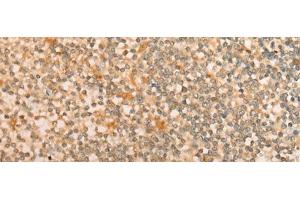 Immunohistochemistry of paraffin-embedded Human tonsil tissue using CFHR2 Polyclonal Antibody at dilution of 1:35(x200) (CFHR2 抗体)