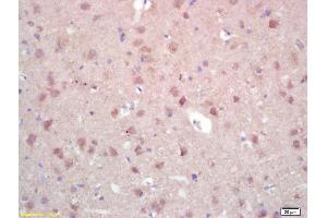 Formalin-fixed and paraffin embedded rat brain labeled with Rabbit Anti ZNF300 Polyclonal Antibody, Unconjugated (ABIN671091) at 1:200 followed by conjugation to the secondary antibody and DAB staining (ZNF300 抗体  (AA 165-250))