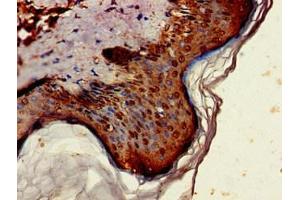 Immunohistochemistry of paraffin-embedded human skin tissue using ABIN7143911 at dilution of 1:100 (ST6GALNAC1 抗体  (AA 36-249))