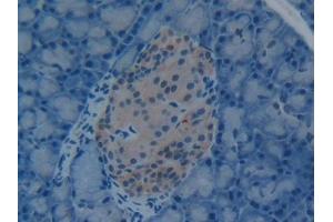 Detection of HMGB1 in Rat Pancreas Tissue using Polyclonal Antibody to High Mobility Group Protein 1 (HMGB1) (HMGB1 抗体  (AA 1-215))