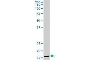 CD99 MaxPab rabbit polyclonal antibody. (CD99 抗体  (AA 1-185))