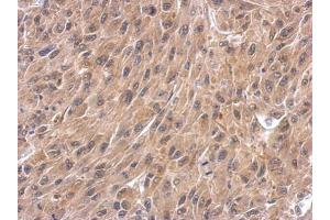 IHC-P Image Immunohistochemical analysis of paraffin-embedded U87 xenograft, using WNT4, antibody at 1:500 dilution. (WNT4 抗体  (Center))