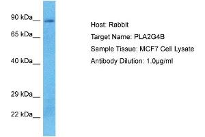 Host: Rabbit Target Name: PLA2G4B Sample Type: MCF7 Whole Cell lysates Antibody Dilution: 1. (PLA2G4B 抗体  (C-Term))