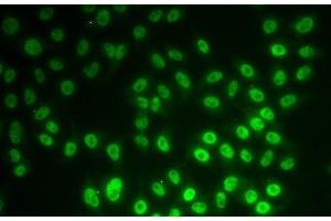 Immunofluorescence analysis of MCF-7 cells using SNRPD1 Polyclonal Antibody (SNRPD1 抗体)