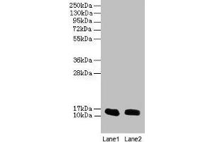 Western blot All lanes: FABP1 antibody at 16 μg/mL Lane 1: Mouse liver tissue Lane 2: Mouse small intestine tissue Secondary Goat polyclonal to rabbit IgG at 1/10000 dilution Predicted band size: 15 kDa Observed band size: 15 kDa (FABP1 抗体  (AA 1-127))