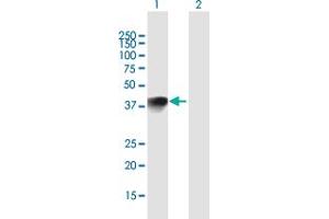 Western Blot analysis of HMX1 expression in transfected 293T cell line by HMX1 MaxPab polyclonal antibody. (HMX1 抗体  (AA 1-348))