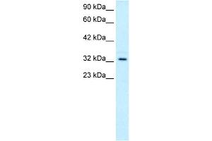 WB Suggested Anti-TAL1 Antibody Titration:  0. (TAL1 抗体  (C-Term))