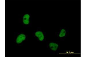 Immunofluorescence of purified MaxPab antibody to MCM7 on HeLa cell. (MCM7 抗体  (AA 1-719))