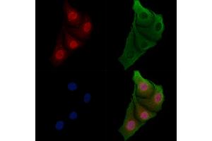 ABIN6257955 and ABIN6273780 staining Hela cells by IF/ICC. (BAG2 抗体  (C-Term))