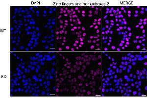 Immunocytochemical staining of HeLa cells using Zinc fingers and homeoboxes 2 antibody (ABIN7800905), 1:1,000), Top panel: wild-type (WT), Bottom panal: Zinc fingers and homeoboxes 2 shRNA knockdown (KD). (Recombinant ZHX2 抗体)