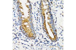 Immunohistochemistry of paraffin-embedded human vermiform appendix using HSPA9 antibody. (HSPA9 抗体  (AA 380-679))