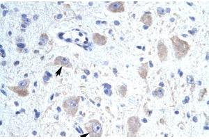 Immunohistochemical staining (Formalin-fixed paraffin-embedded sections) of human brain with KCNIP1 polyclonal antibody . (KCNIP1 抗体  (N-Term))