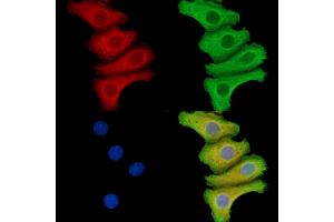 SEPN1 Antibody staining Hela cells by IF/ICC. (SEPN1 抗体)