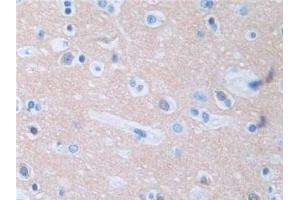 DAB staining on IHC-P; Samples: Human Cerebrum Tissue (Protein Phosphatase 3, Regulatory Subunit 1 (AA 2-170) 抗体)