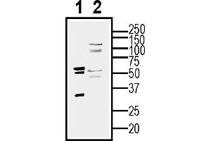Western blot analysis of human  MG glioblastoma cell line lysate (lane 1) and  MG-derived purified exosomes (lane 2)50 μg of cells and purified exosomes lysates were analyzed using Anti-CD9 (extracellular) Antibody (ABIN7581848), (1:200). (CD9 抗体  (Extracellular))