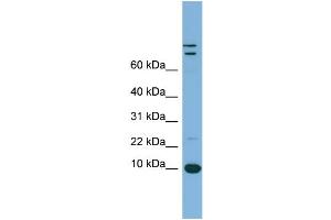 WB Suggested Anti-TFF1 Antibody Titration:  0. (TFF1 抗体  (Middle Region))