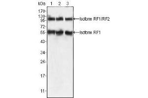 Western Blot showing PEG10 antibody used against HepG2 (1), SMMC-7721 (2) and A549 (3) cell lysate. (PEG10 抗体)