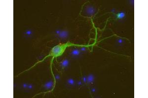 Indirect immunostaining of PFA fixed rat hippocampus neurons with anti-FBXO 41 (dilution 1 : 500; red) and mouse anti-MAP 2 (cat. (FBXO41 抗体)