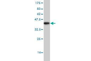 Western Blot detection against Immunogen (36. (TRIP6 抗体  (AA 51-148))