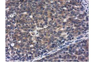 Immunohistochemical staining of paraffin-embedded Human Kidney tissue using anti-CBWD1 mouse monoclonal antibody. (CBWD1 抗体)