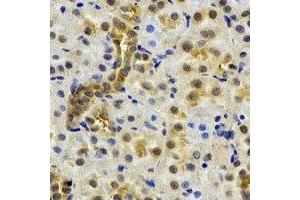 Immunohistochemical analysis of NAT13 staining in rat kidney formalin fixed paraffin embedded tissue section.
