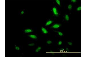 Immunofluorescence of monoclonal antibody to TSC22D4 on HeLa cell. (TSC22D4 抗体  (AA 1-395))