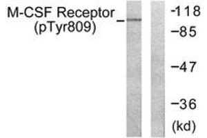Western Blotting (WB) image for anti-Colony Stimulating Factor 1 Receptor (CSF1R) (AA 781-830), (pTyr809) antibody (ABIN1531339)