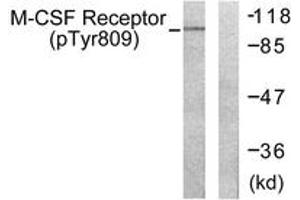 Western blot analysis of extracts from 293 cells treated with LPS 100ng/ml 30', using M-CSF Receptor (Phospho-Tyr809) Antibody. (CSF1R 抗体  (pTyr809))