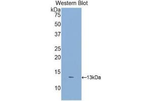 Western Blotting (WB) image for anti-Dickkopf 2 Homolog (DKK2) (AA 159-258) antibody (ABIN3207349) (DKK2 抗体  (AA 159-258))