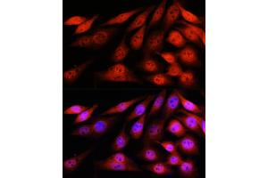 Immunofluorescence analysis of NIH-3T3 cells using VCP Rabbit mAb (ABIN7271284) at dilution of 1:100 (40x lens). (VCP 抗体)