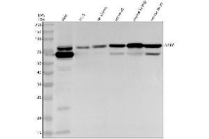 Western blot analysis of NPRC using anti-NPRC antibody (ABIN7605743).