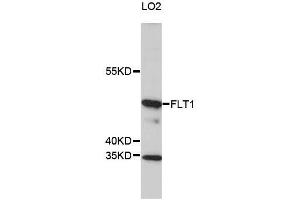 Western blot analysis of extracts of LO2 cells, using FLT1 antibody (ABIN5969988) at 1/1000 dilution. (FLT1 抗体)