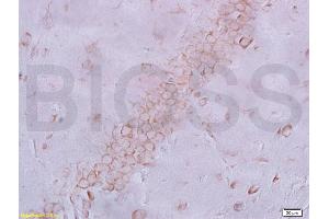 Frozen section rat brain labeled with Anti-NeuN Polyclonal Antibody, Unconjugated (ABIN732068) at 1:200 followed by conjugation to the secondary antibody and DAB staining (NeuN 抗体  (AA 51-150))