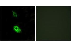 Immunofluorescence analysis of HeLa cells, using EDG3 Antibody. (S1PR3 抗体  (AA 1-50))